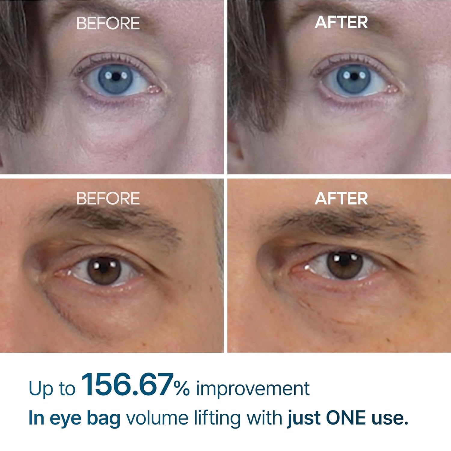 Dr.Melaxin Eyephalt Eyebag Cream 10ml